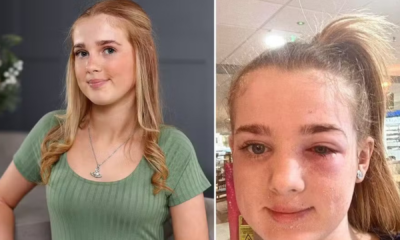 portal plural adolescente quase perde a visão após seguir dicas de beleza de vídeo da internet