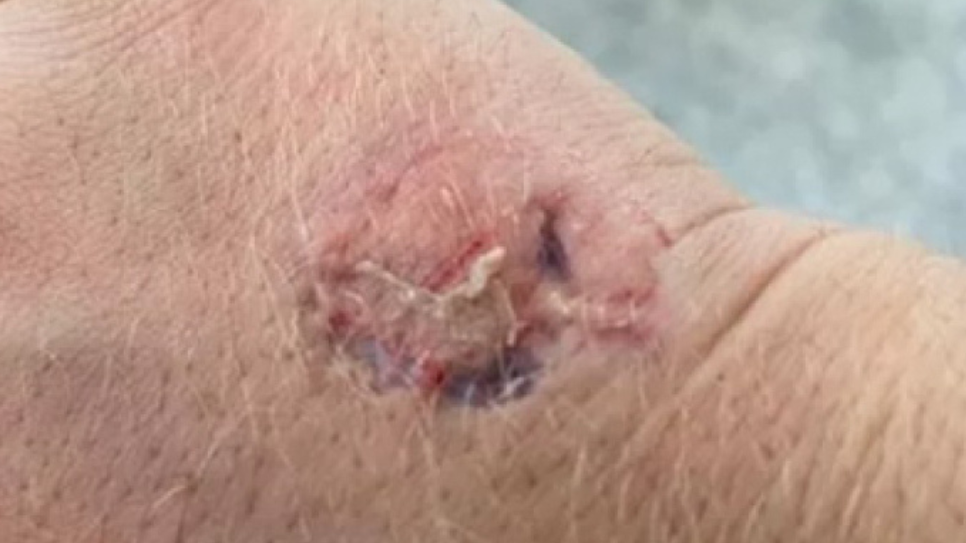 portal plural mordida pm