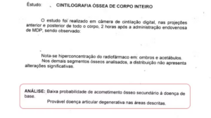 portal plural por causa de erro médico, mulher trata câncer inexistente durante 6 anos