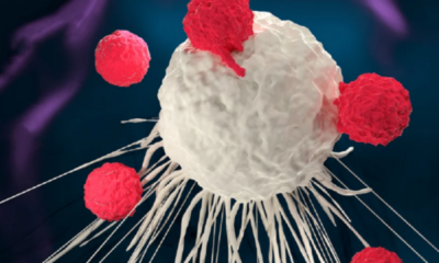 portal plural terapia car t promete revolucionar o tratamento contra o câncer