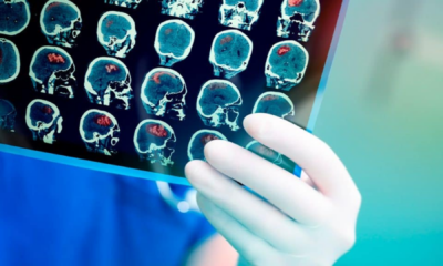 portal plural nova ia revoluciona pesquisa contra o câncer