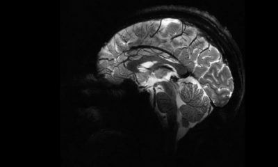 portal plural máquina de ressonância produz primeira imagem do cérebro humano com alta precisão