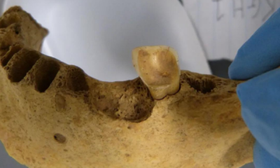 portal plural por que nossos antepassados não sofriam de cáries nova pesquisa explica