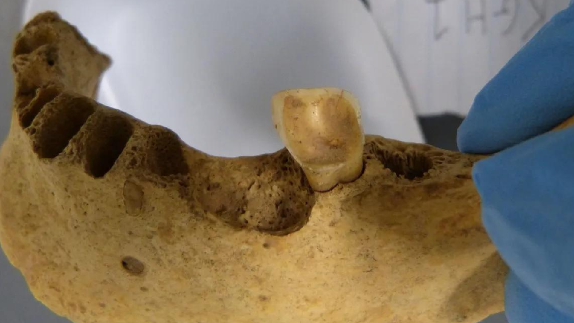 portal plural por que nossos antepassados não sofriam de cáries nova pesquisa explica