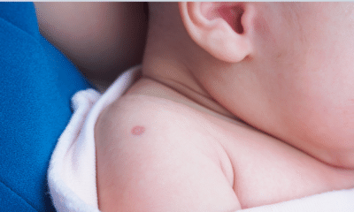 portal plural cobertura da vacina bcg no brasil atinge 75,3% em 2024