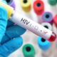 portal plural cura da aids entenda o que novo caso tem de diferente para aumentar a esperança de novos tratamentos contra o vírus hiv