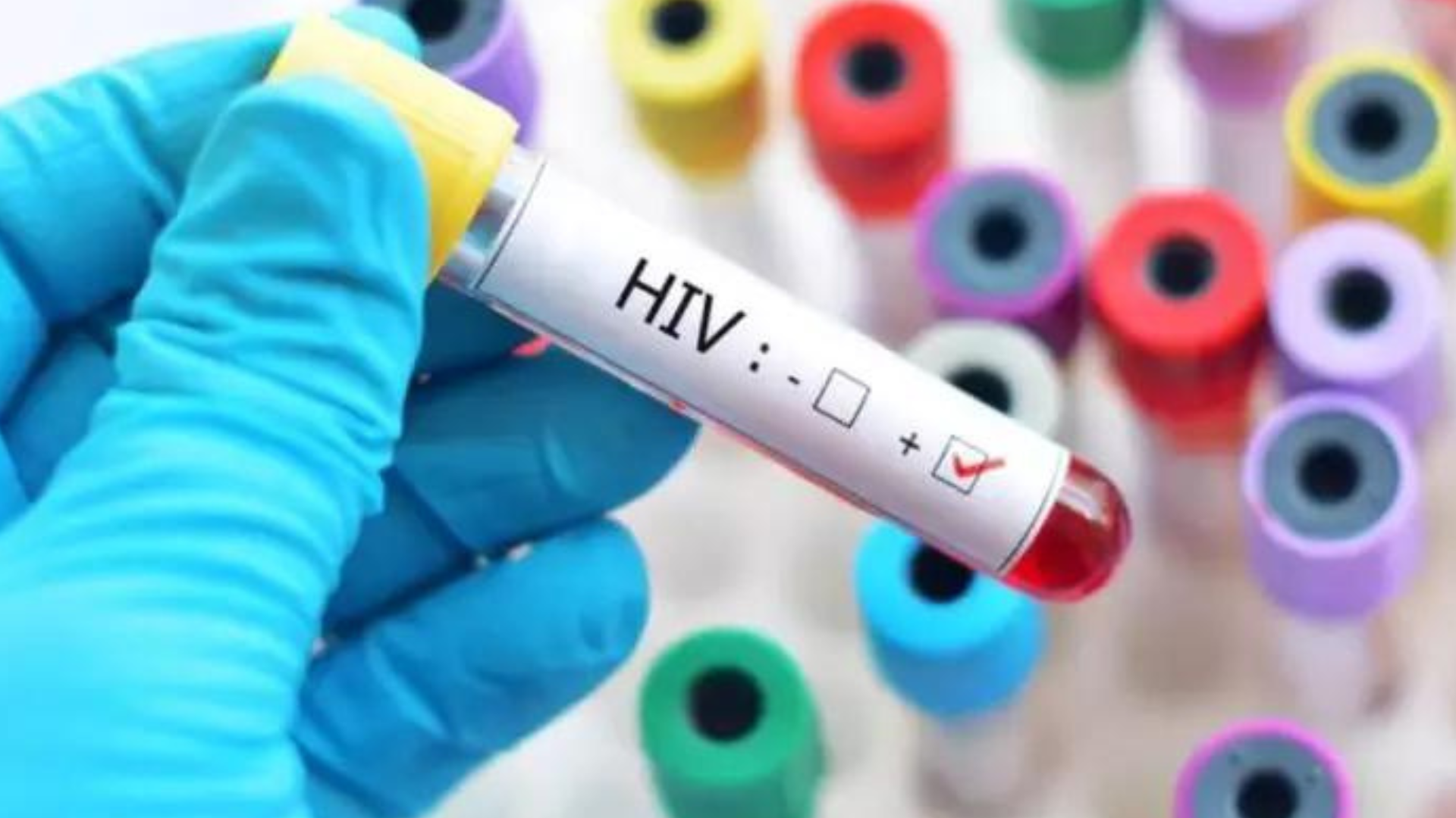 portal plural cura da aids entenda o que novo caso tem de diferente para aumentar a esperança de novos tratamentos contra o vírus hiv