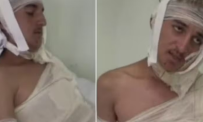 portal plural jovem é queimado com óleo quente em ataque homofóbico