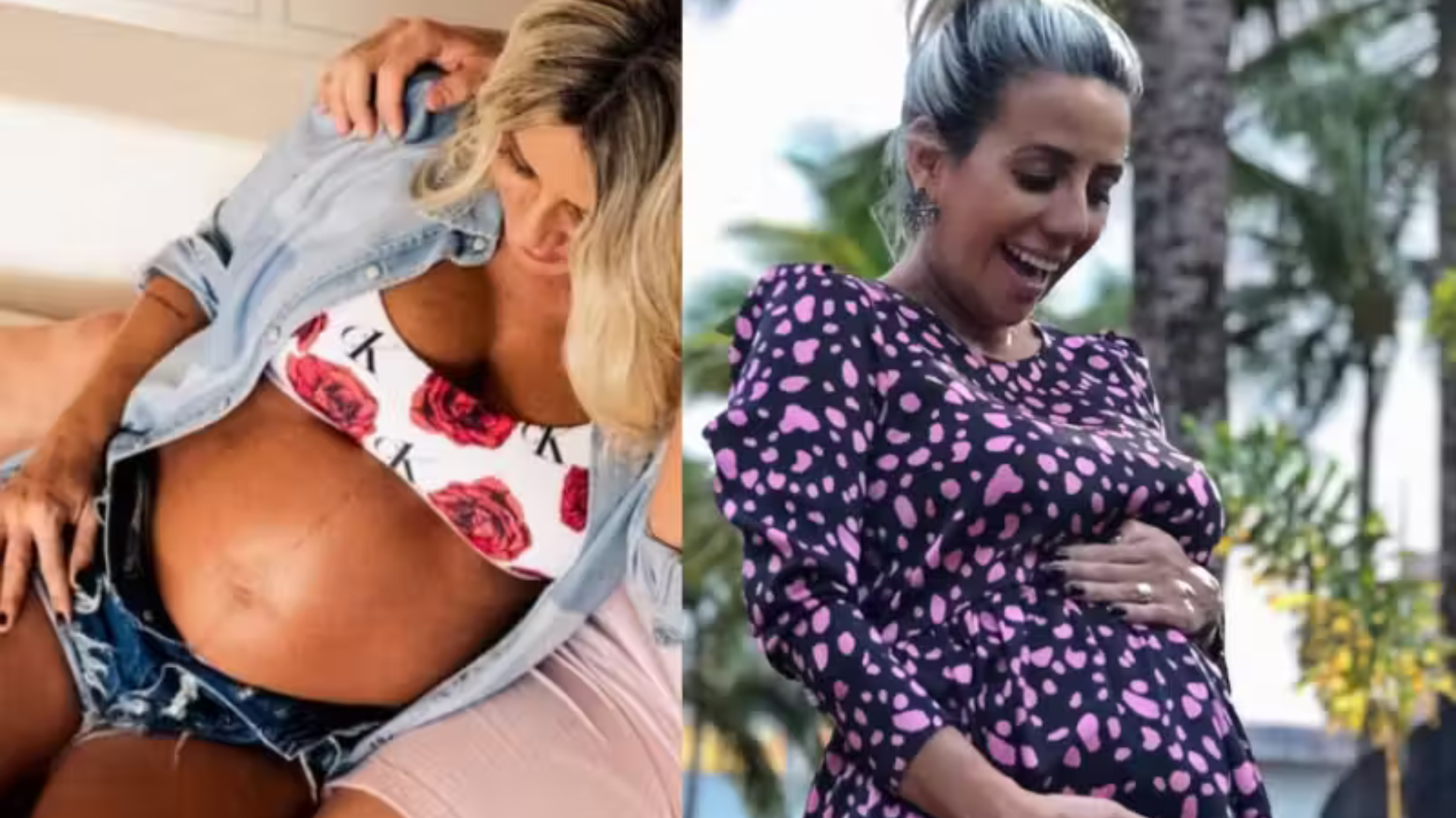 portal plural mulher com 2 úteros supera estatísticas e realiza sonho de ser mãe