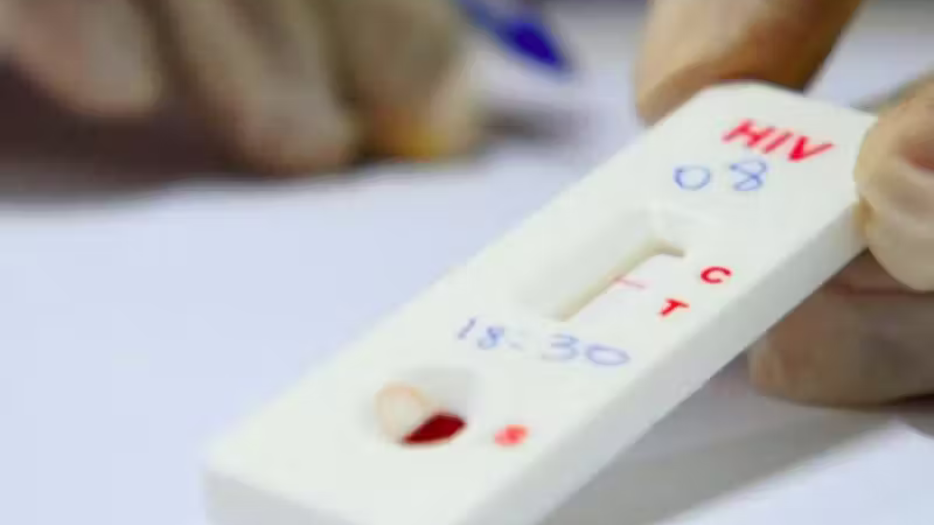 portal plural sétimo caso de cura do hiv vem com uma reviravolta