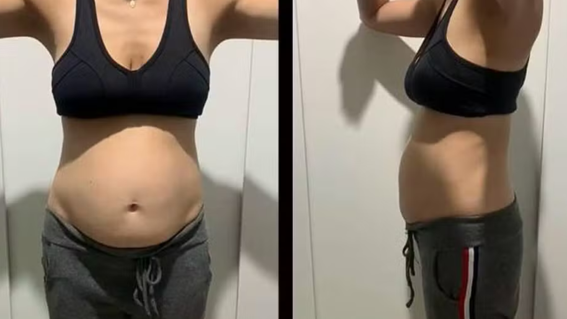 portal plural diástase abdominal entenda em 10 pontos a condição que faz a barriga das mulheres aumentar