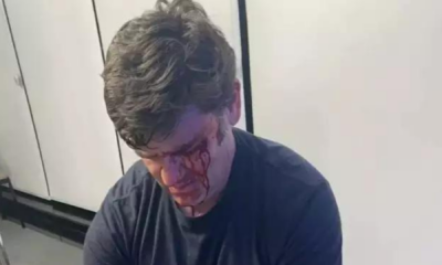 portal plural marqueteiro do prefeito de são paulo leva seis pontos após ser agredido por assessor de pablo marçal