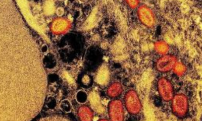 portal plural mpox brasil registra 945 casos desde o começo do ano e ultrapassa marca de 2023