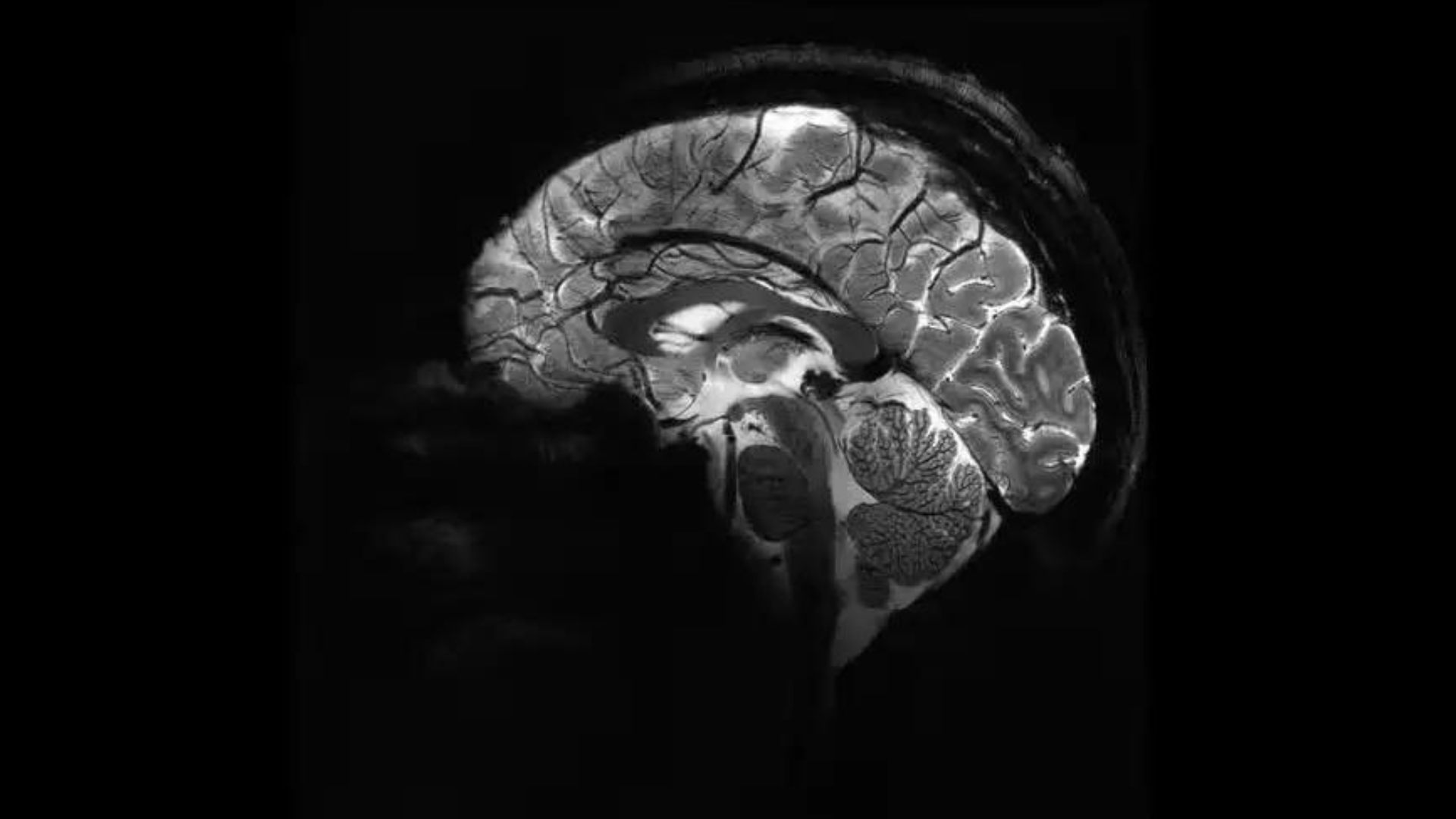 portal plural neurociência cérebro dos homens “encolhe” entre as 7h e 20h, depois reinicia