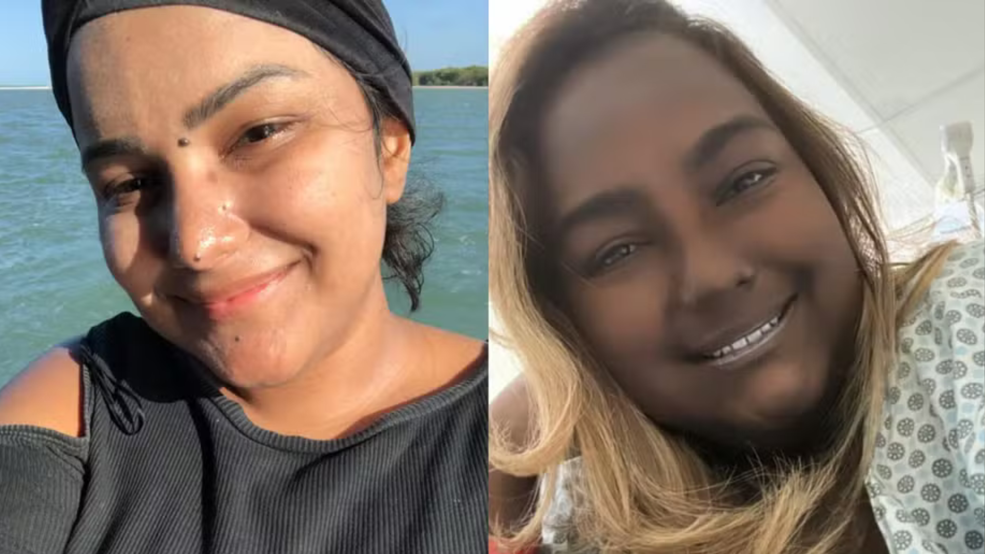 portal plural jovem tem tumor raro que muda a cor da pele