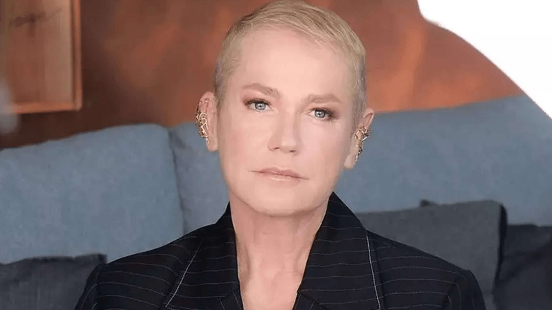 portal plural xuxa fala sobre alopecia e transplante capilar “quis fazer para mim”
